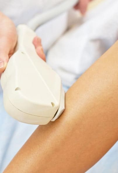 IPL-Laser-Treament-2