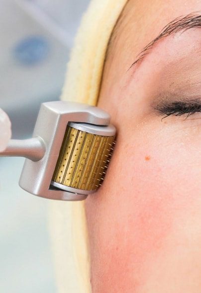 prp-dermaroller-treatment-1 (1)