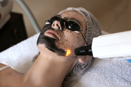 Carbon Facial Laser Toning Dermcure skin, hair, and laser center dr. Aastha Shukla and Dr. Utkarsh Shukla