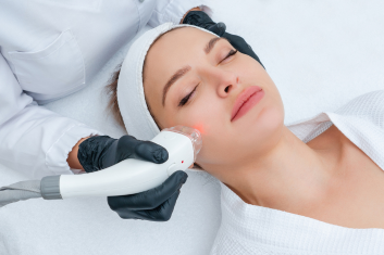 Laser Toning Dermcure skin, hair, and laser center dr. Aastha Shukla and Dr. Utkarsh Shukla